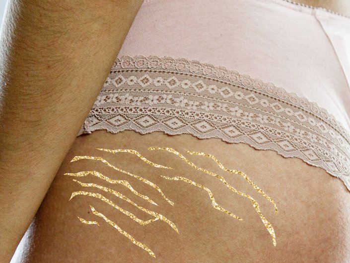 close-up of glitter stretch marks on person's hip