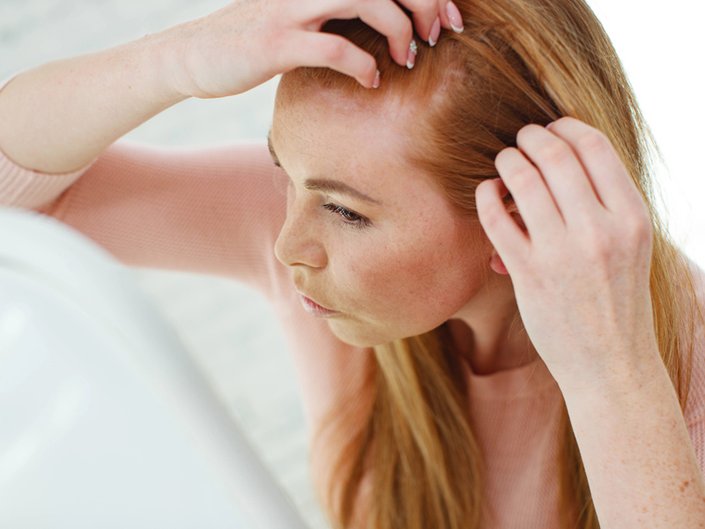 hairstyles-to-disguise-receding-hairline