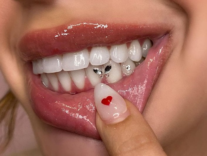 What You Should Know Before Getting Tooth Gems