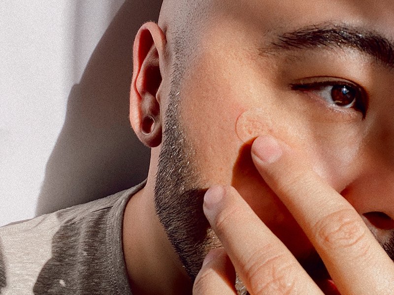 How to Wear Pimple Patches Under Makeup